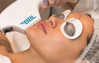 BBL процедура: фотоомоложение нового поколения — полный гид